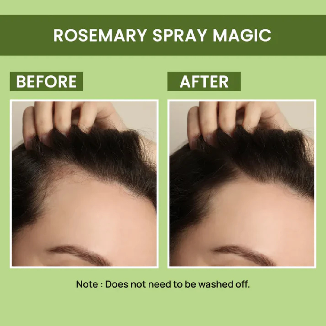 🌿100% Original Rosemary Water Spray for Hair Growth 200ml 😍BUY 1 GET 1 FREE😍